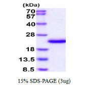 Human IL1F9 protein, His tag. GTX68627-pro