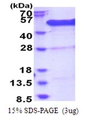 Human BCCIP protein, His tag. GTX68630-pro