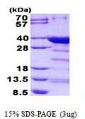Human NRIP3 protein, His tag. GTX68632-pro