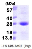 Human SAR1A protein, His tag. GTX68633-pro