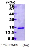 Human LGALS14 protein, His tag. GTX68635-pro
