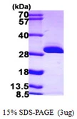 Human BDH2 protein, His tag. GTX68636-pro