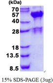 Human SH3GLB2 protein, His tag. GTX68637-pro