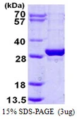 Human EXOSC5 protein, His tag. GTX68638-pro
