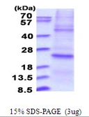 Human DUSP22 protein, His tag. GTX68641-pro