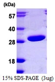 Human PRTFDC1 protein, His tag. GTX68642-pro