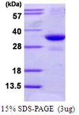 Human PSMG2 protein, His tag. GTX68644-pro