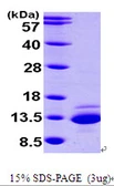 Human CTNNBIP1 protein, His tag. GTX68645-pro