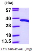 Human PDXP protein, His tag. GTX68648-pro