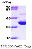 Human TIGAR protein, His tag. GTX68650-pro