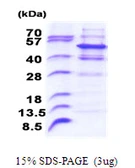 Human Pellino 2 protein, His tag. GTX68652-pro