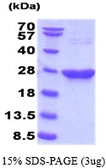 Mouse Park7 / DJ-1 protein, His tag. GTX68654-pro