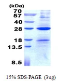 Human AICDA protein, His tag. GTX68655-pro