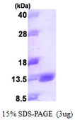 Human S100A14 protein, His tag. GTX68656-pro