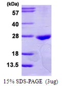 Human RAB22A protein, His tag. GTX68657-pro