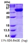 Human CYT19 protein, His tag. GTX68659-pro