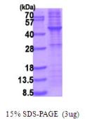 Human TRIB3 protein, His tag. GTX68665-pro
