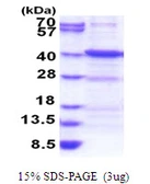 Human ANKRA2 protein, His tag. GTX68666-pro