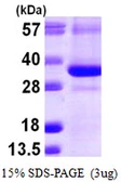 Human CTDSP1 protein, His tag. GTX68669-pro