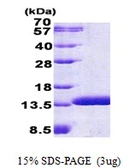 Human ABRACL protein, His tag. GTX68674-pro
