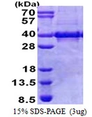 Human Myozenin 1 protein, His tag. GTX68675-pro