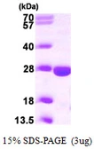 Human PPCDC protein, His tag. GTX68680-pro