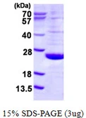 Human DUSP21 protein, His tag. GTX68683-pro
