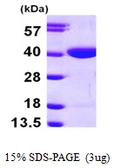 Human RBKS protein, His tag. GTX68687-pro