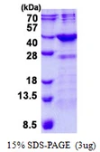 Human FN3K protein, His tag. GTX68692-pro