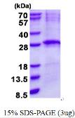 Human LIN7B protein, His tag. GTX68693-pro