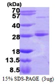Human RAB17 protein, His tag. GTX68694-pro