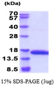 Rat Profilin 1 protein, His tag. GTX68695-pro