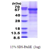Human CPEB1 protein, His tag. GTX68699-pro