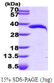 Human NMNAT1 protein, His tag. GTX68702-pro