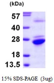 Human GNPNAT1 protein, His tag. GTX68703-pro