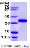 Human OTUB2 protein, His tag. GTX68715-pro