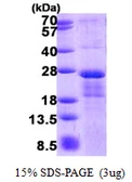 Human MRI protein, His tag. GTX68716-pro
