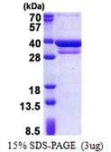 Human CUEDC2 protein, His tag. GTX68718-pro