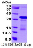 Human DBNDD1 protein, His tag. GTX68719-pro