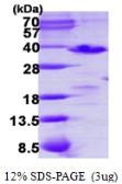 Human PDCL3 protein, His tag. GTX68722-pro