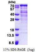 Human TUG protein, His tag. GTX68725-pro