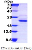 Human XTP3TPA protein, His tag. GTX68726-pro