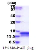 Human CHCHD7 protein, His tag. GTX68727-pro