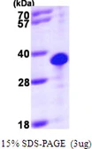 Human THTPA protein, His tag. GTX68728-pro