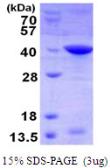 Human Livin protein, His tag. GTX68730-pro