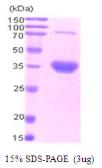 Human Livin protein, His tag. GTX68731-pro