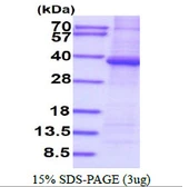 Human PPP1R3B protein, His tag. GTX68736-pro