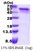 Human NEIL1 protein, His tag. GTX68737-pro