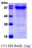 Human HSPBAP1 protein, His tag. GTX68738-pro