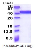 Human PLEKHF2 protein, His tag. GTX68739-pro